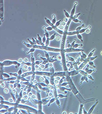 A microscopic view of a Trichoderma Harzianum cell